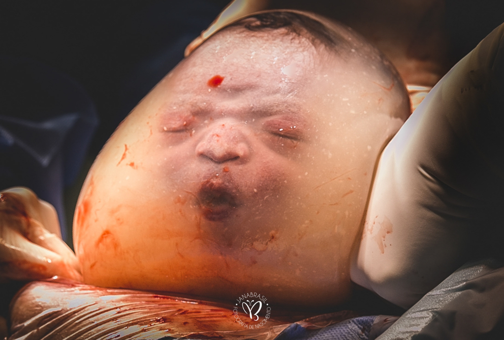 best birth photography revealed & the images are stunning